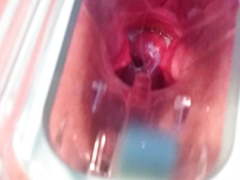 Cumming w speculum